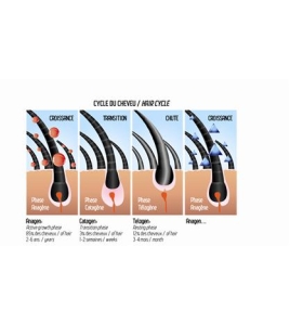 PROCAPIL'HAIR ŠAMPON + LOSION - Anti DHT